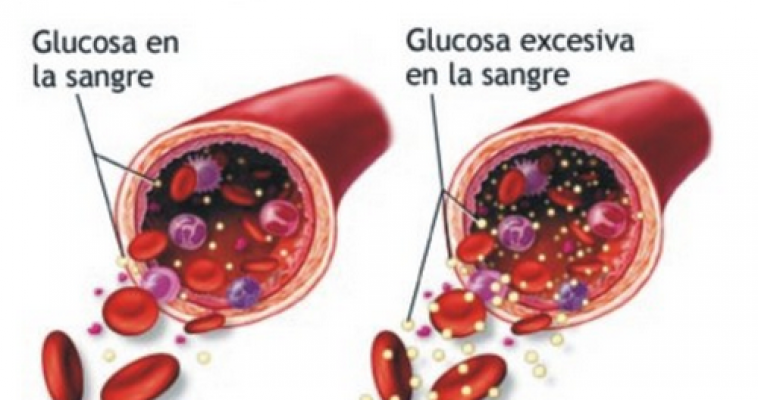 Consecuencia Del Exceso De Glucosa En El Cuerpo Instituto Nacional Del Diabetico 2576